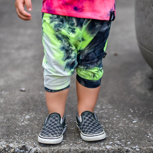 RTS Yellow Neon Tie Dye Shorts